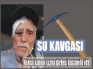 Su kavgas kanl bitti