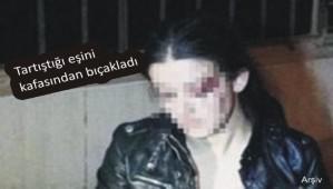 Karsn kafasndan baklad