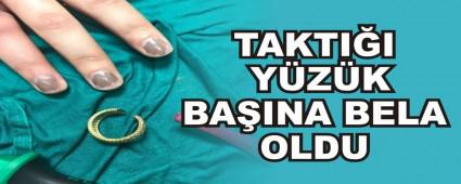 TAKTII YZK BAINA BELA OLDU