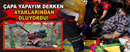 APA YAPAYIM DERKEN AYAKLARINDAN OLUYORDU!