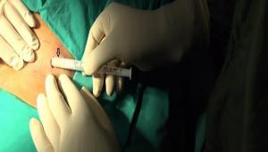 BAB\'DE MADDE BAIMLILIINA KARI P TEDAV