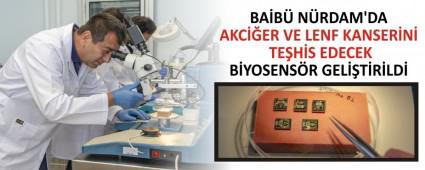 BAB NRDAM\'DA AKCER VE LENF KANSERN TEHS EDECEK BYOSENSR GELTRLD